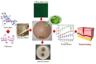 EcoFriendly Wound Dressing  Banana Fibre  Developed By Indian Scientists  വാഴനാരുകള്‍ കൊണ്ടൊരു ബാന്‍ഡേജ്  ഇന്ത്യന്‍ ശാസ്‌ത്രജ്ഞര്‍