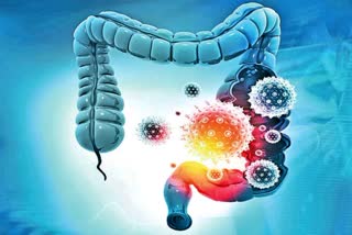 Colon Cancer is Now Been Seeing in 40s Age