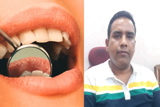 wisdom tooth treatment