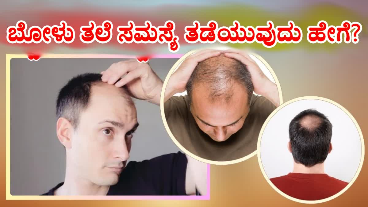 How To Prevent Premature Baldness  Tips to prevent baldness problem