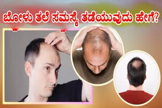 How To Prevent Premature Baldness  Tips to prevent baldness problem