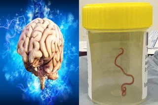 brain eating parasite found in Australian woman