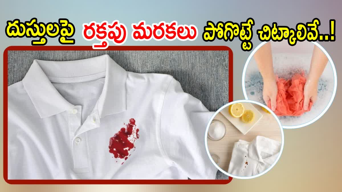 How to Remove Blood Stains