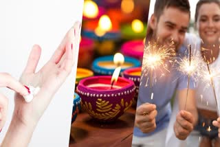 FIRST AID IN BURN ACCIDENT AND FIRECRACKERS PRECAUTIONS DURING DIWALI