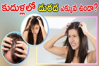 How to Stop An Itchy Scalp in Winter