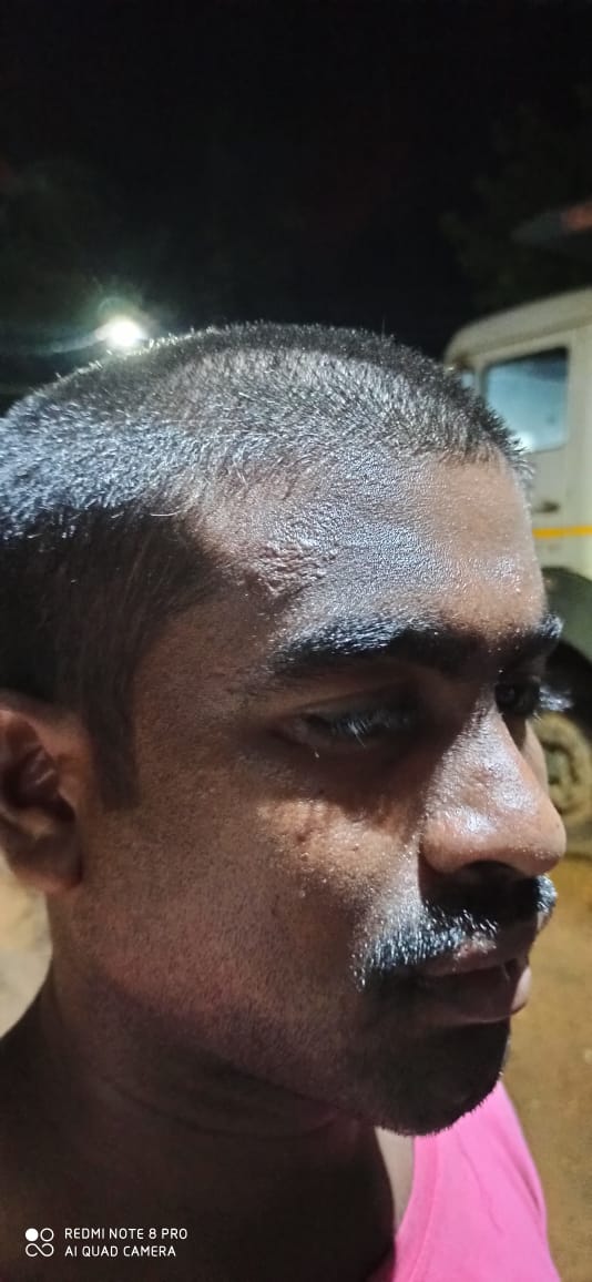 Police tonsured hairs and moustaches during the police custody