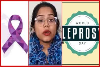 30 जनवरी को विश्व कुष्ठ रोग दिवस
