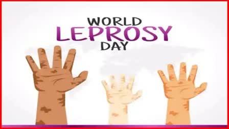 World Leprosy Day 2024