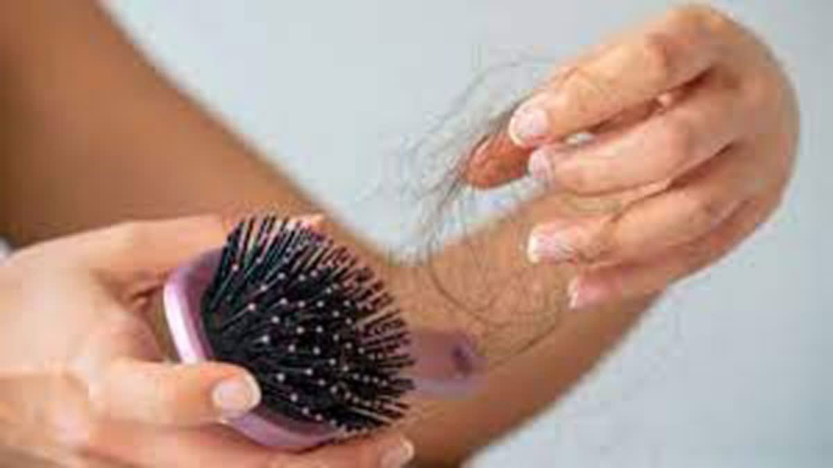 Natural Treatments For Hair Loss