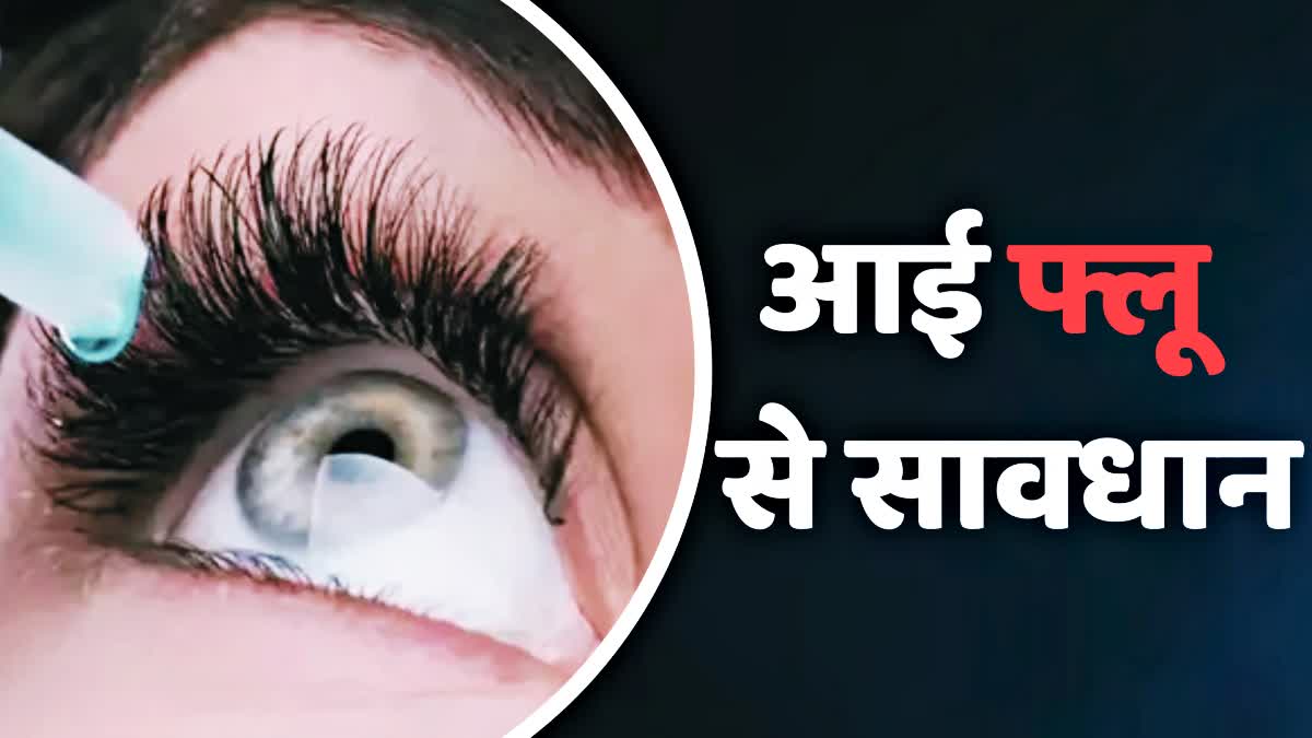 eye flu in karnal