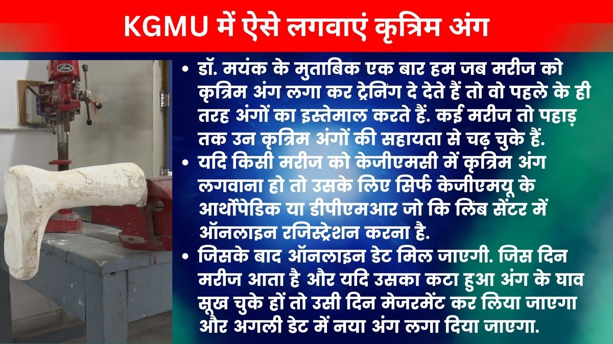 किंग जार्ज मेडिकल यूनिवर्सिटी के लिंब सेंटर में लगाए जाते हैं कृत्रिम अंग.