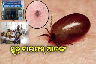 ସୁନ୍ଦରଗଡରେ ସ୍କ୍ରବ ଟାଇଫସ ଆତଙ୍କ