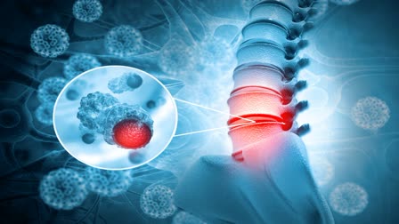 spine pain causes and treatment