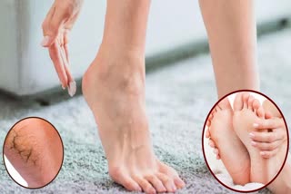 Foot Care Tips for Winter