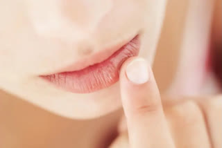 Don't make this mistake when it comes to lips in winter