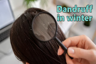 Dandruff worsens in the cold months