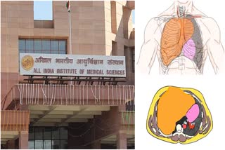 Jodhpur AIIMS