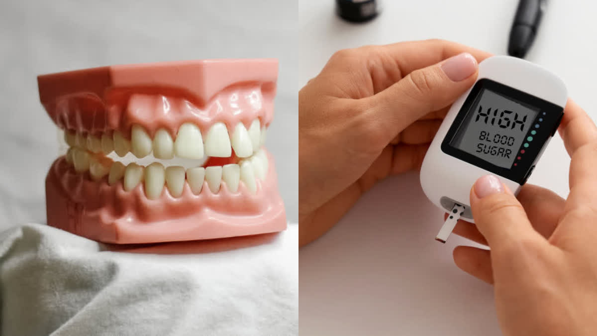 Diabetes can cause gum disease, tooth decay and cavity problems, know what research says