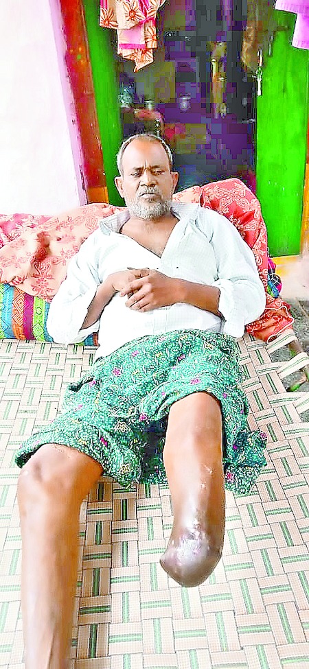 Venkatashivareddy lost his leg and was confined to bed