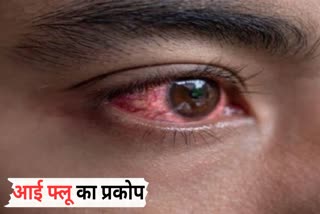 Ashoknagar Eye flu News