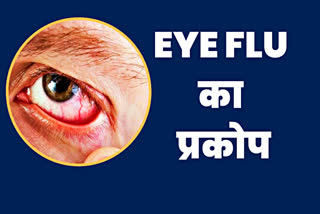 Eye Flu Cases In Himachal