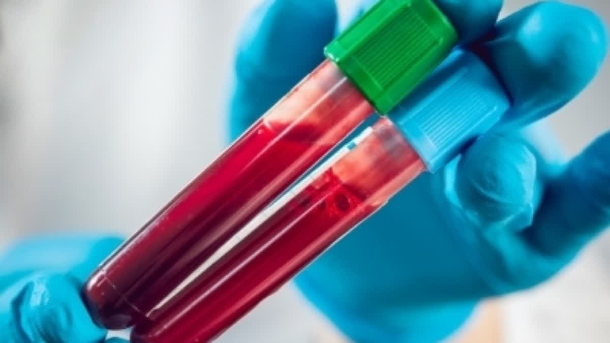 Simple blood test can help diagnose bipolar disorder more accurately  മാനസിക പ്രയാസങ്ങള്‍ അലട്ടുന്നുണ്ടോ  രക്ത സാമ്പിളിലൂടെ രോഗം കണ്ടെത്താം  Diagnose Bipolar Disorder Find Through Blood Test  Bipolar Disorder  Blood Test  ബൈപോളാര്‍ ഡിസോര്‍ഡര്‍  രക്ത പരിശോധന  യുകെയിലെ കോംബ്രിഡ്‌ജ് യൂണിവേഴ്‌സിറ്റി