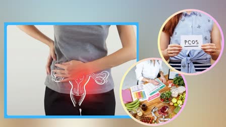 FOOD GUIDE FOR PCOS WOMEN