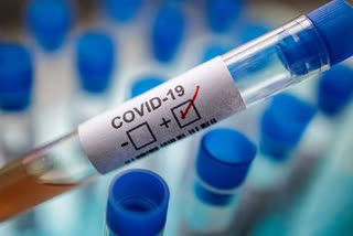 Two doctors among 19 hospital staff f test positive for COVID-19 ഉദംപൂർ ജില്ലാ ആശുപത്രി കൊവിഡ് സ്ഥിരീകരിച്ചു