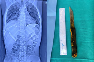 20cm knife removed from man's liver