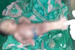 women-gave-birth-to-a-strange-baby-in-jalgaon