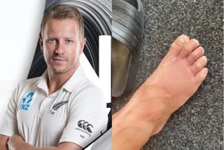 NZ pacer Wagner bowls with fractured toe, takes 2 wickets against Pakistan