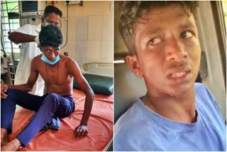 honey-bees-attack-on-student-at-udupi