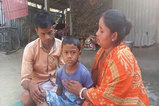 6 year old boy from Raiganj has severe aplastic anemia