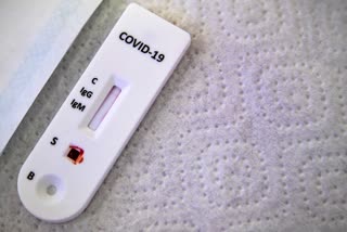 25 students test positive for coronavirus in Madikeri
