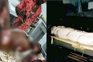 man-who-fell-into-the-boiled-oil-is-dead