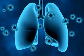 Happy Hypoxia in COVID-19