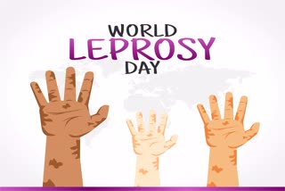 Importance of Leprosy day