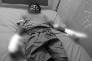Serious injuries to boy in Cell Phone blast in Ramayapalem, Vizianagaram district