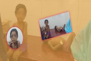 6-year-old-girl-and-4-year-old-boy-was-brutally-beaten-by-father-and-stepmother