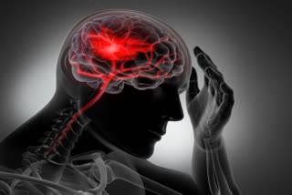 मस्तिष्क क्षति, स्ट्रोक, types of brain stroke