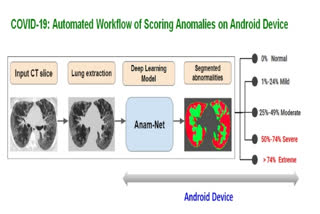 AI-based software tool for automated diagnosis of COVID-19 lung infection