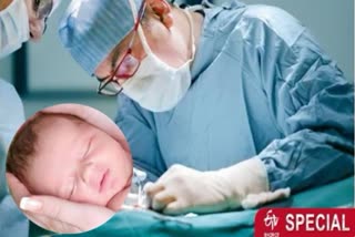 Cesarean delivery