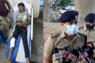 Firing on Notorious rowdy sheeter in Bengaluru  കുപ്രസിദ്ധ ഗുണ്ട നേതാവ് അറസ്‌റ്റിൽ  ബെംഗളൂരു  bengaluru  Notorious rowdy sheeter in Bengaluru  Firing on Notorious rowdy sheeter  ഗുണ്ട നേതാവ് അറസ്‌റ്റിൽ  ചഡ്ഡി കിരൺ  chaddi kiran  kiran chaddi  kiran  chaddi  ചഡ്ഡി  കിരൺ  നന്ദിനി ലേയൗട്ട്  നന്ദിനി ലേയൗട്ട് പൊലീസ് സ്‌റ്റേഷൻ  nandhini layout  nandhini layout police  nandhini layout police station