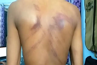 student brutally beaten,  student beaten for mobile