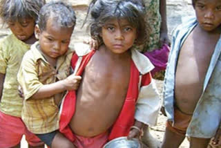 karnataka-first-in-south-india-child-malnutrition-rate