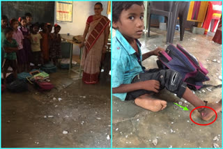 student were injured at satyavolu primary school in nellore