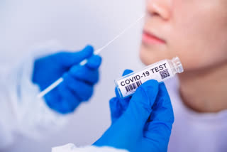 antigen test in uttar pradesh