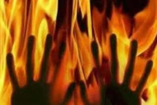 woman-poured-diesel-on-her-jau-and-set-it-on-fire