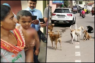 Street dogs attacks on a boy standing by the side of the road