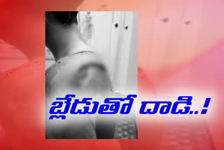 one man injured in a attack at gajuvaka vizag district